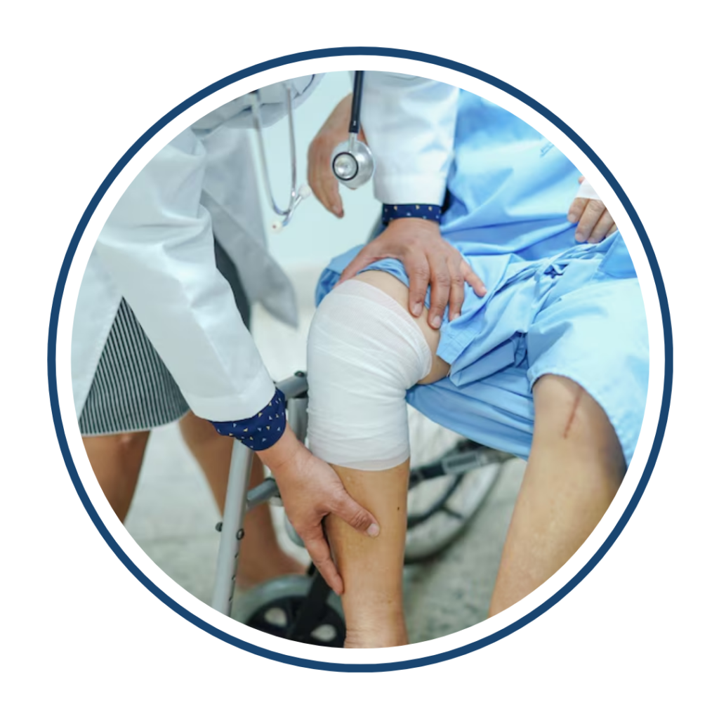 Complicated Joint Fracture Surgery