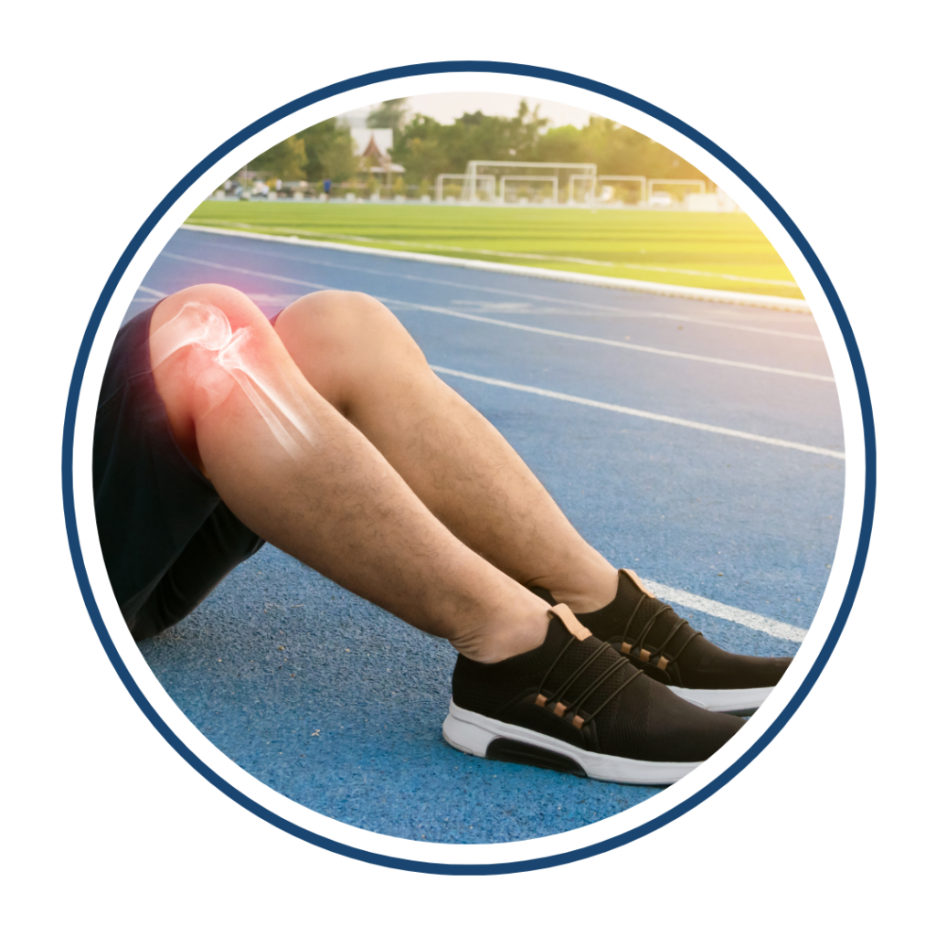 Habitual Dislocation of Patella